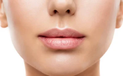 Aumento de Labios en Málaga: Ciencia y Belleza en Perfecta Armonía